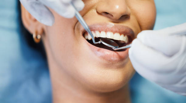 Best Emergency Broken Tooth Repair in Navarre, FL